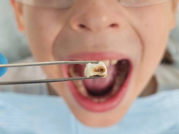 Best Emergency Pediatric Dental Care in Norwood, NJ